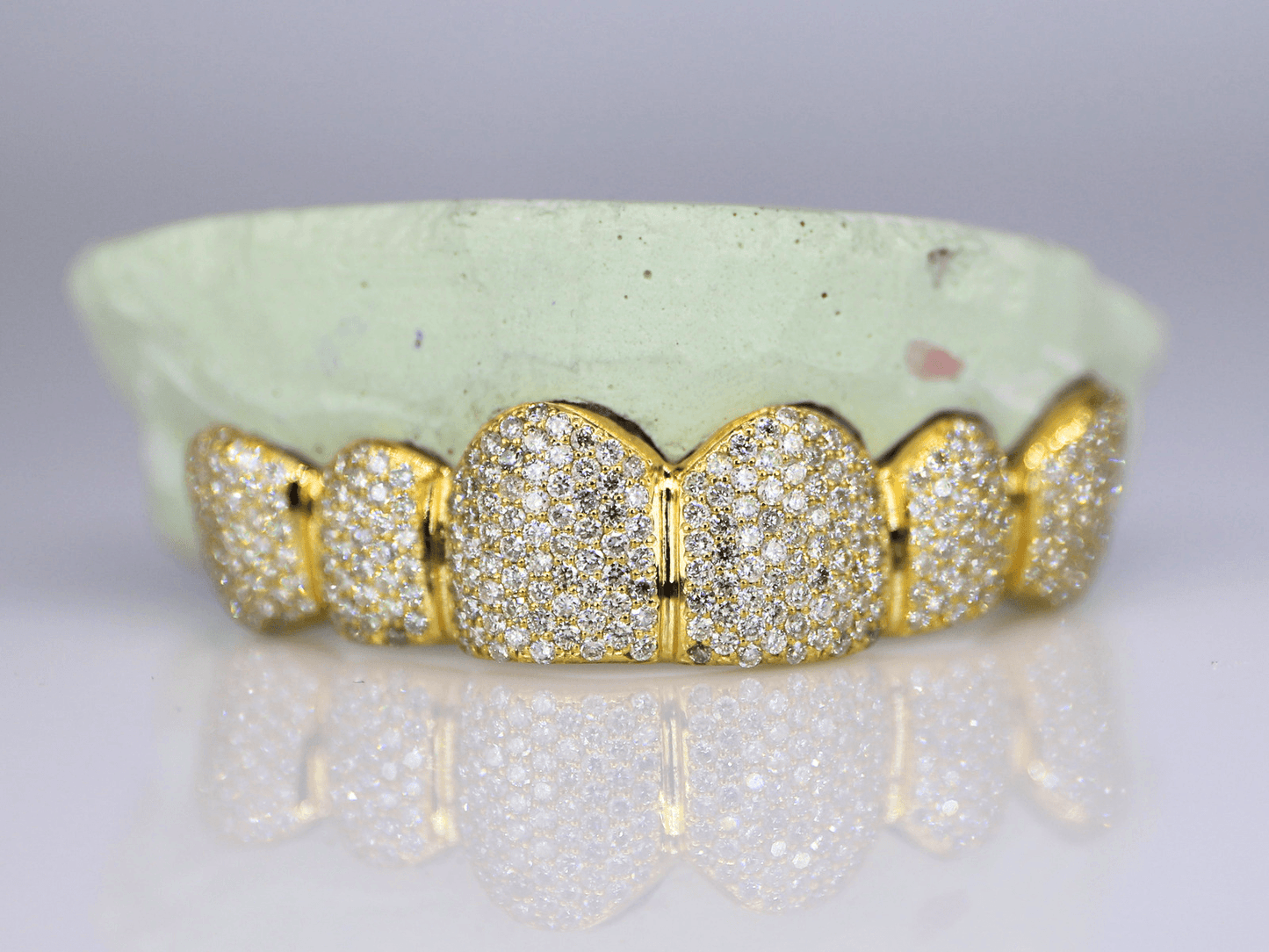 6 on 6 VVS Moissanite Diamond Grillz - Moissanite Bazaar - moissanitebazaar.com