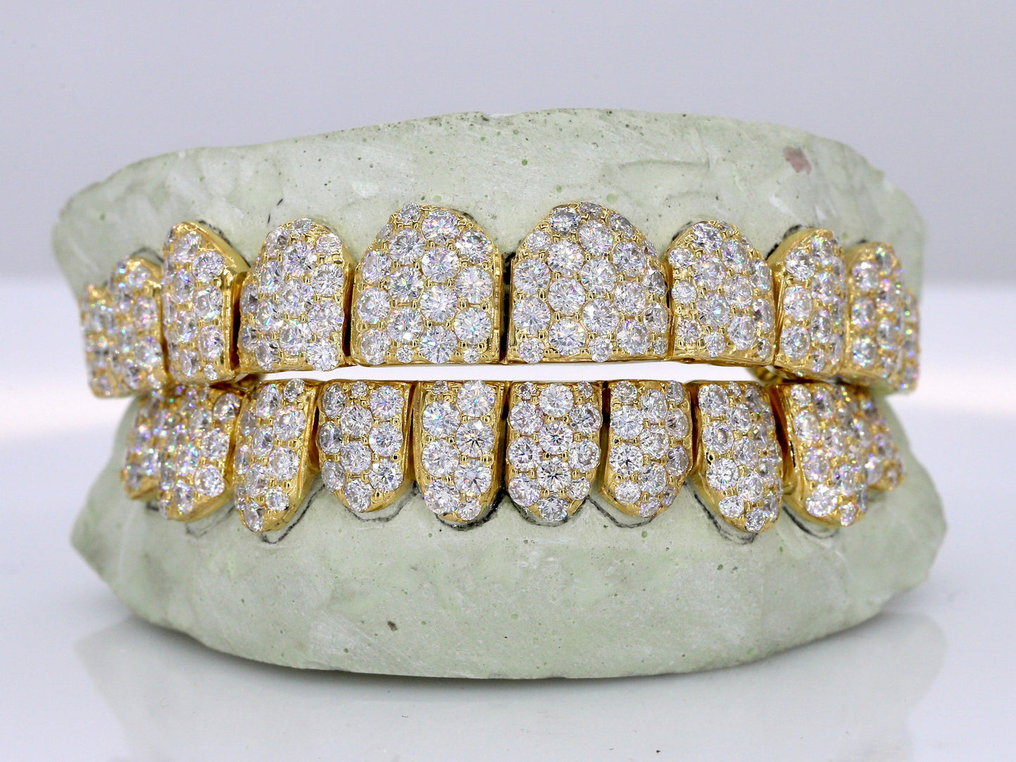 Jumbo VVS Moissanite Diamond Grillz - Moissanite Bazaar - moissanitebazaar.com
