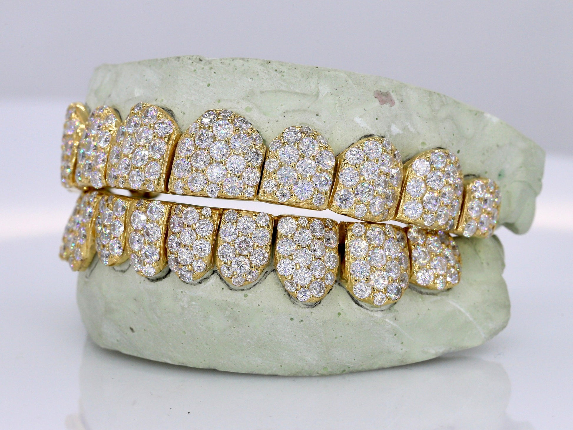 Jumbo VVS Moissanite Diamond Grillz - Moissanite Bazaar - moissanitebazaar.com