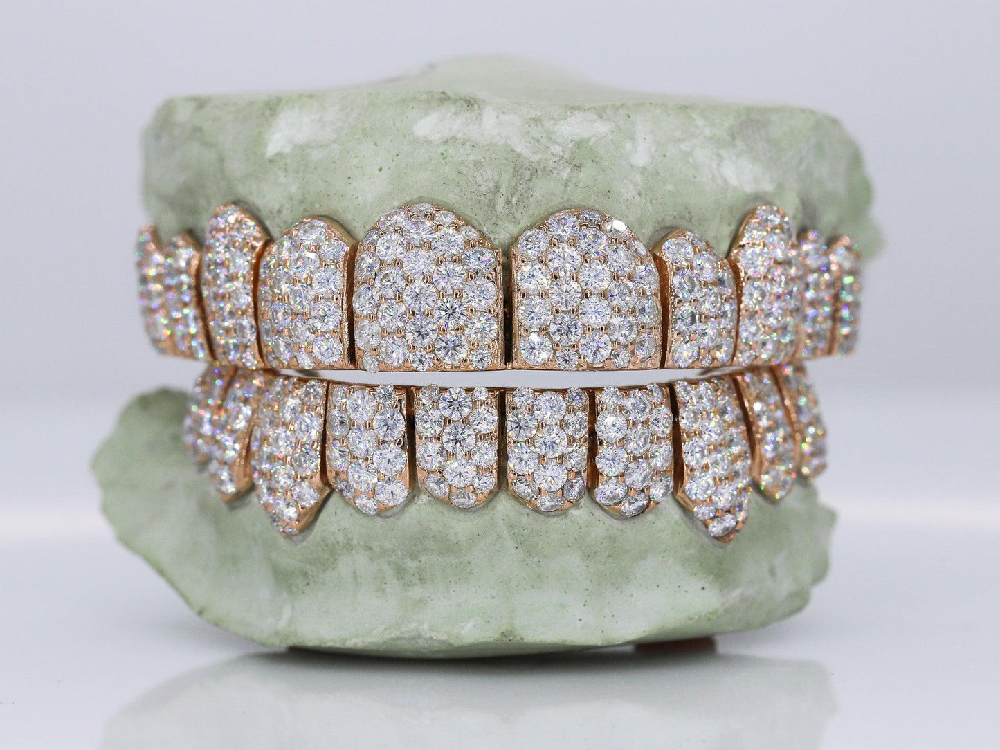 Jumbo VVS Moissanite Diamond Grillz - Moissanite Bazaar - moissanitebazaar.com