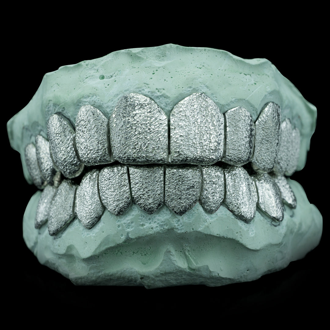 Custom Solid Gold Diamond Dust Grillz