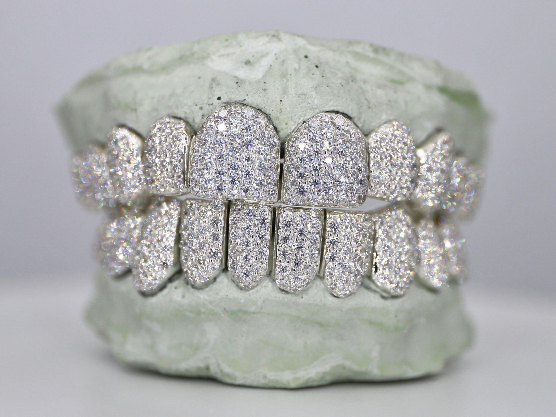 Custom Moissanite Diamond Grillz - Moissanite Bazaar - moissanitebazaar.com