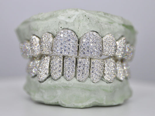 Custom Moissanite Diamond Grillz - Moissanite Bazaar - moissanitebazaar.com