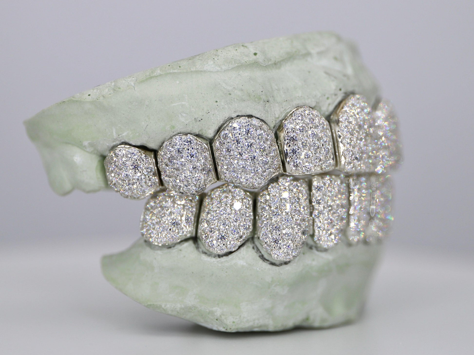 Custom Moissanite Diamond Grillz - Moissanite Bazaar - moissanitebazaar.com