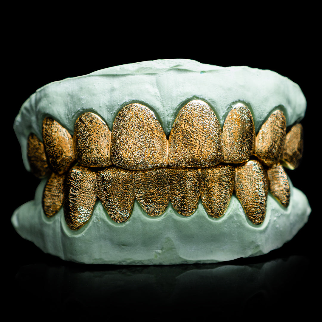 Custom Solid Gold Diamond Dust Grillz
