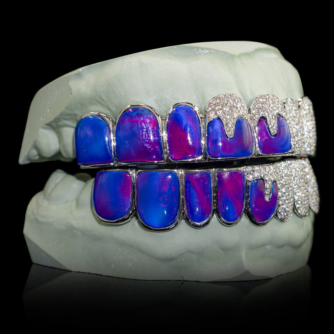Iced Opals with VVS Moissanite Drips Grillz