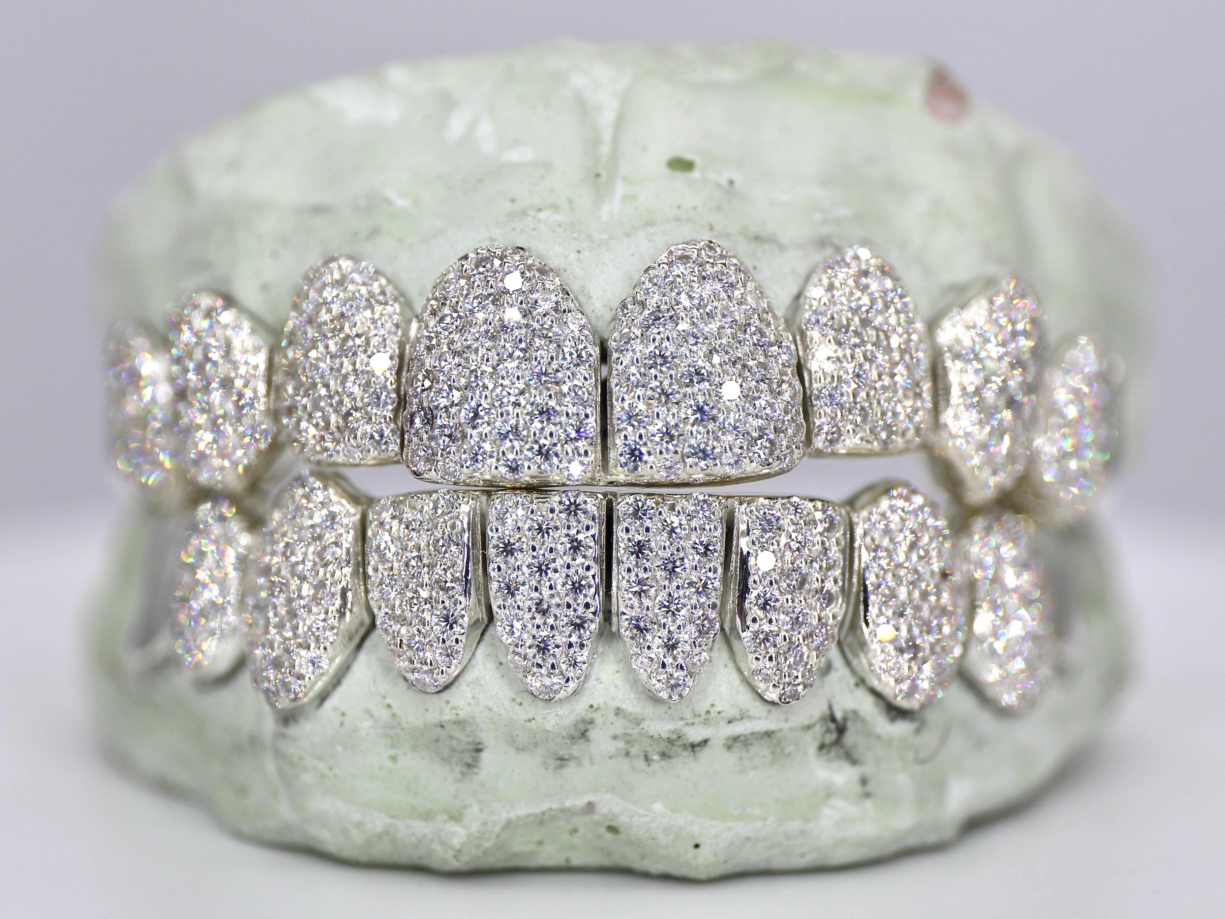 10 on 10 Capped VVS Moisannite Diamond Grillz - Moissanite Bazaar - moissanitebazaar.com