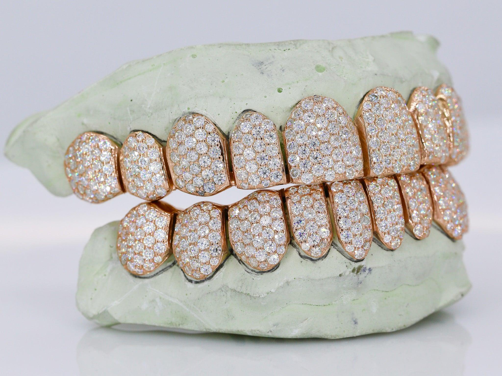 10 on 10 VVS Moisannite Diamond Grillz - Moissanite Bazaar - moissanitebazaar.com