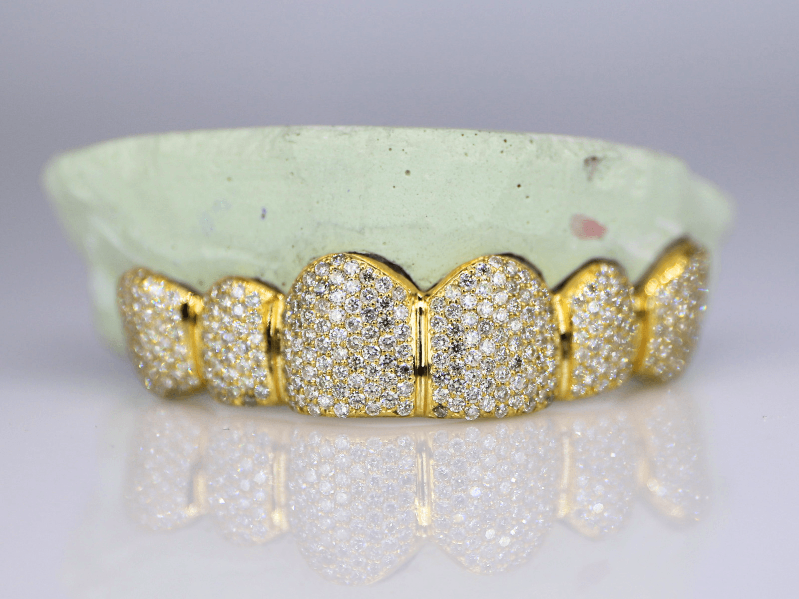 6 on 6 VVS Moissanite Diamond Grillz - Moissanite Bazaar - moissanitebazaar.com