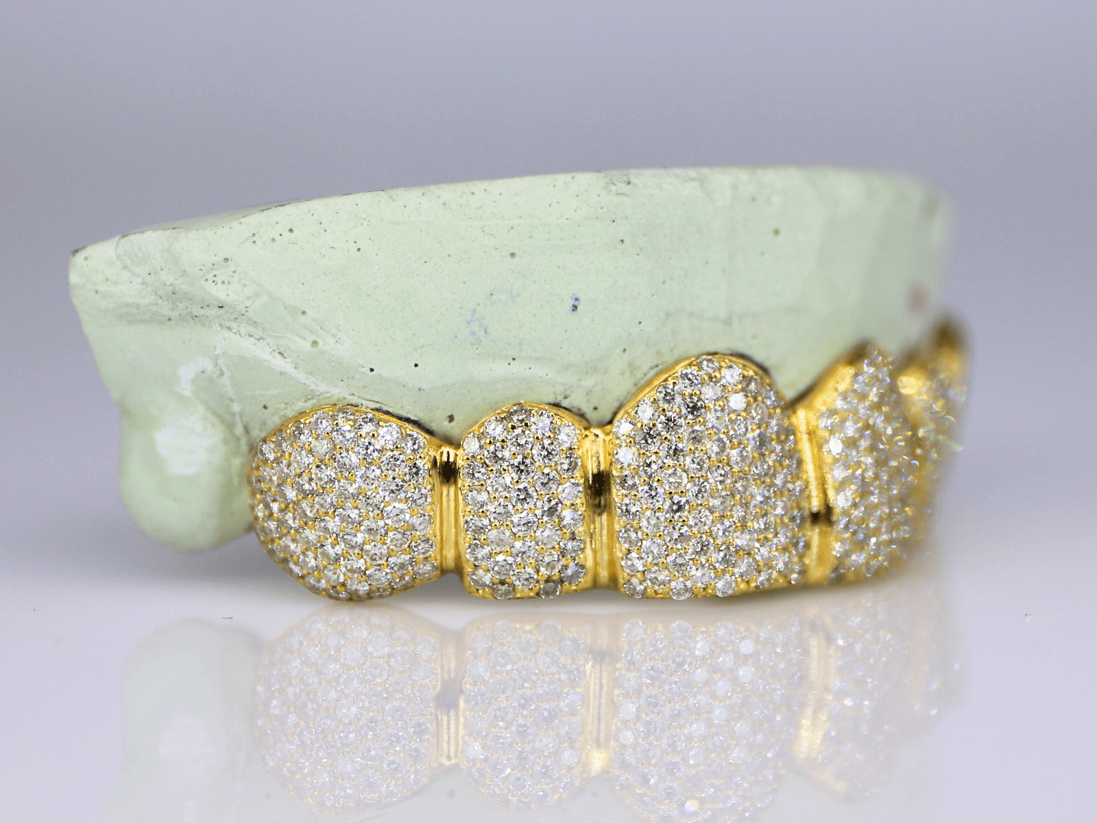 6 on 6 VVS Moissanite Diamond Grillz - Moissanite Bazaar - moissanitebazaar.com
