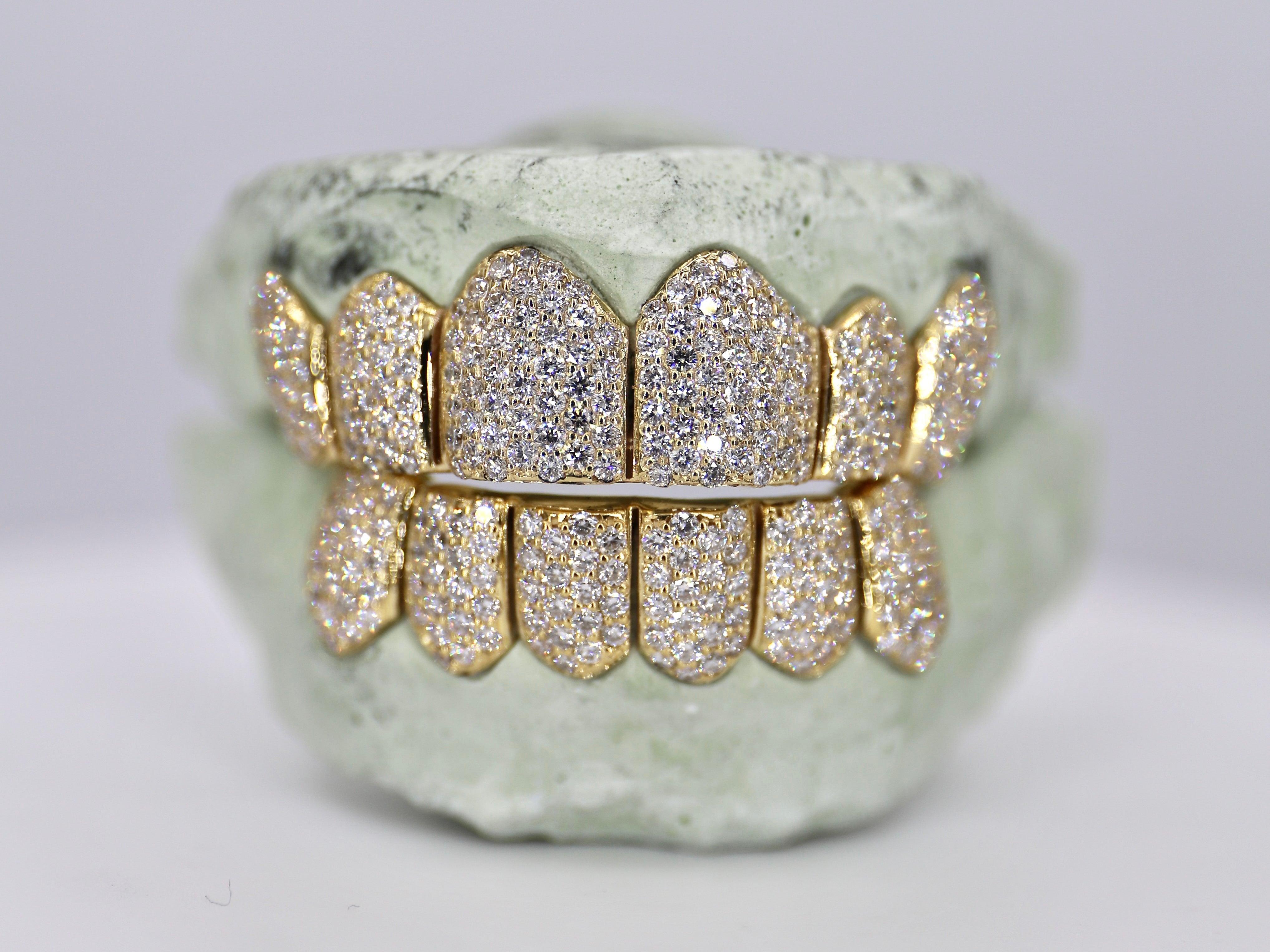 6 on 6 VVS Moissanite Diamond Grillz - Moissanite Bazaar - moissanitebazaar.com