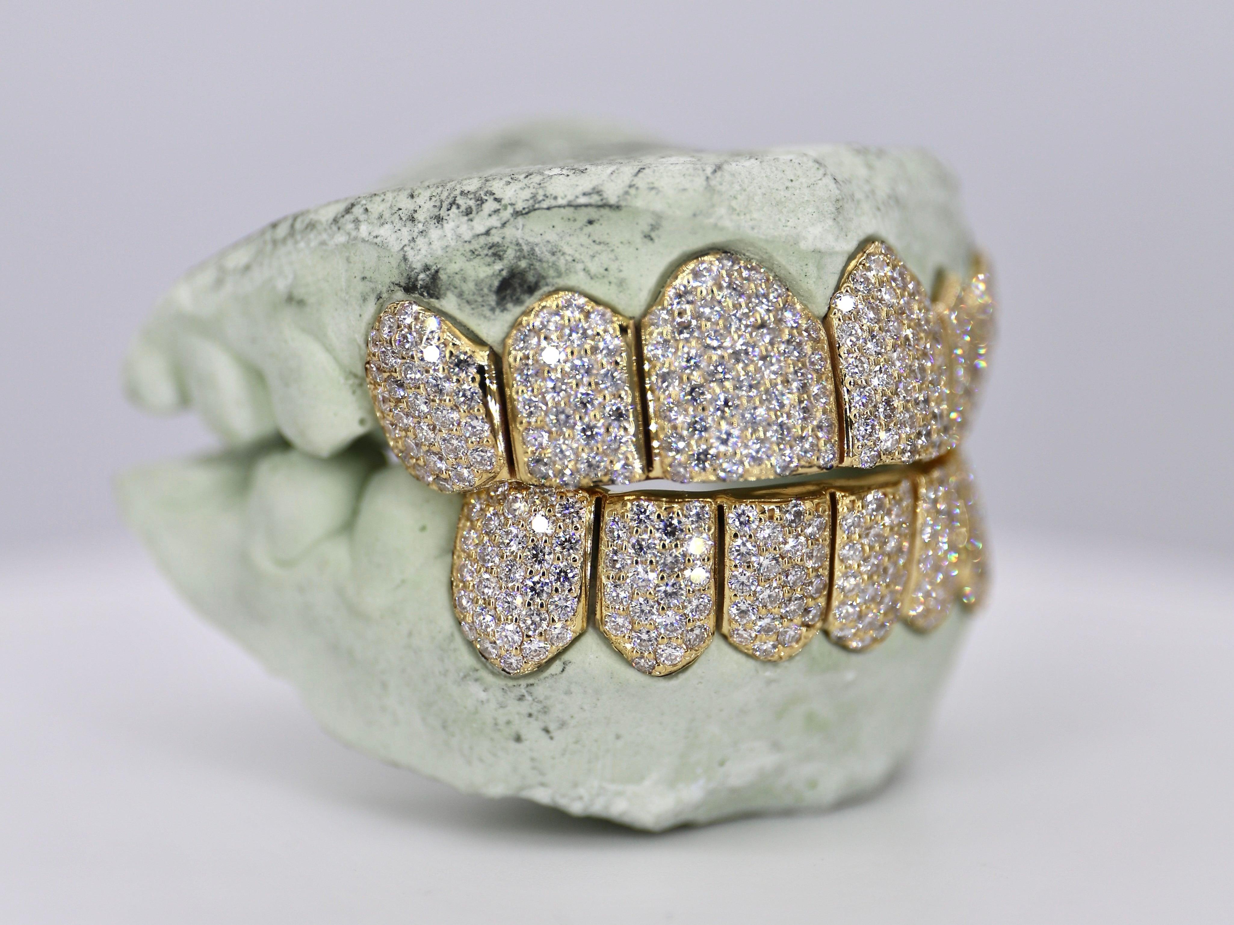 6 on 6 VVS Moissanite Diamond Grillz - Moissanite Bazaar - moissanitebazaar.com
