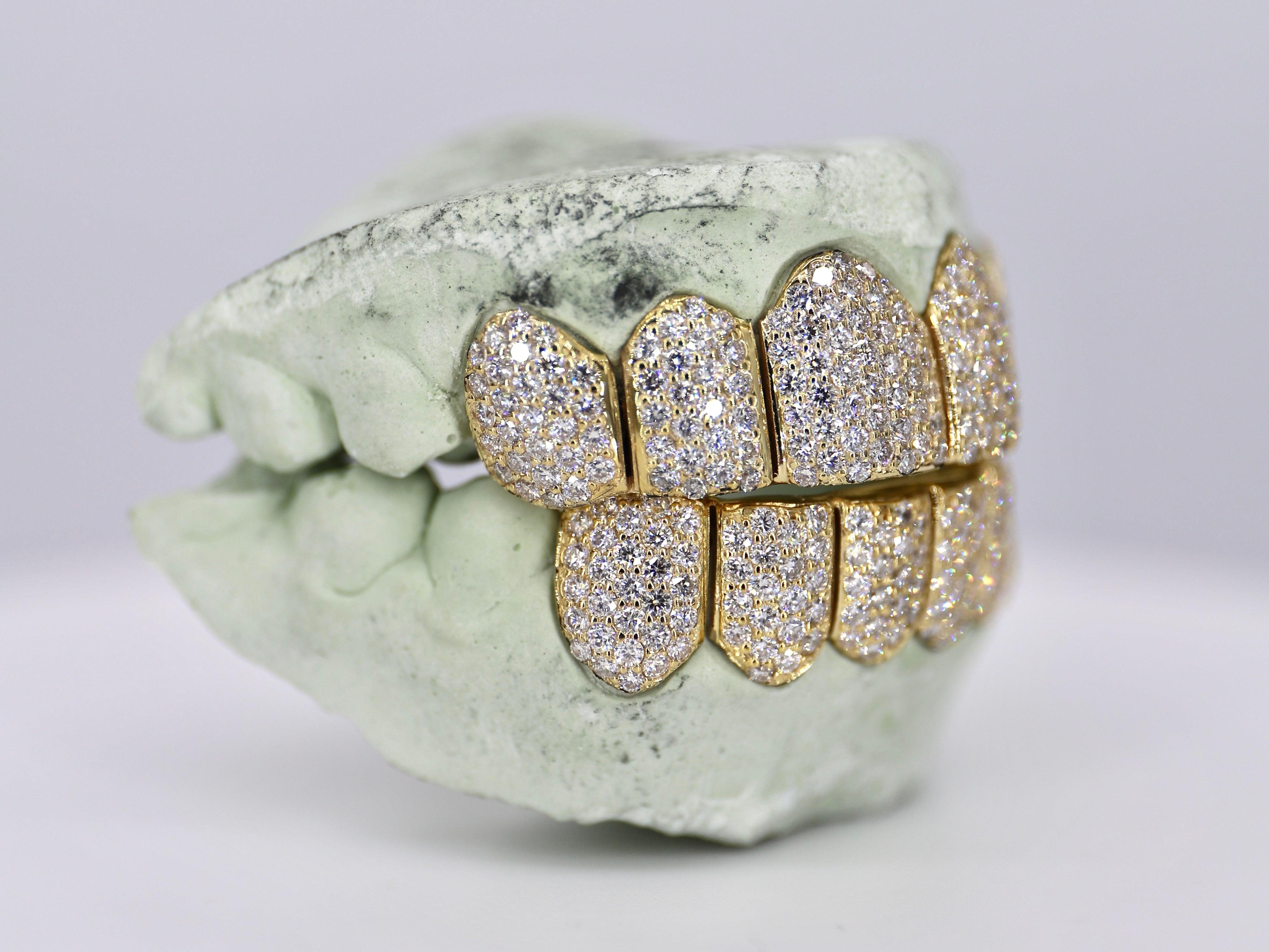 6 on 6 VVS Moissanite Diamond Grillz - Moissanite Bazaar - moissanitebazaar.com