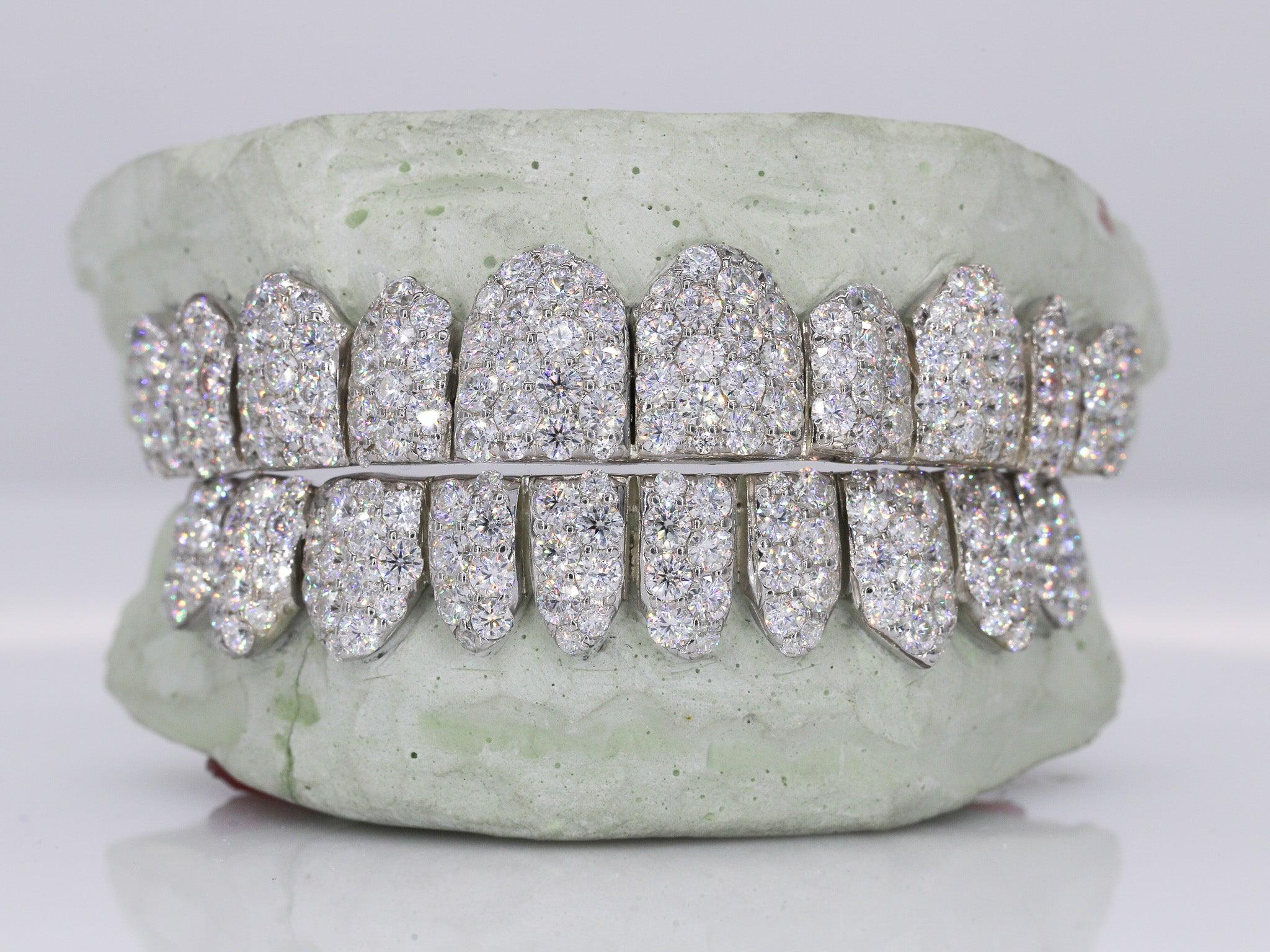 Jumbo VVS Moissanite Diamond Grillz - Moissanite Bazaar - moissanitebazaar.com