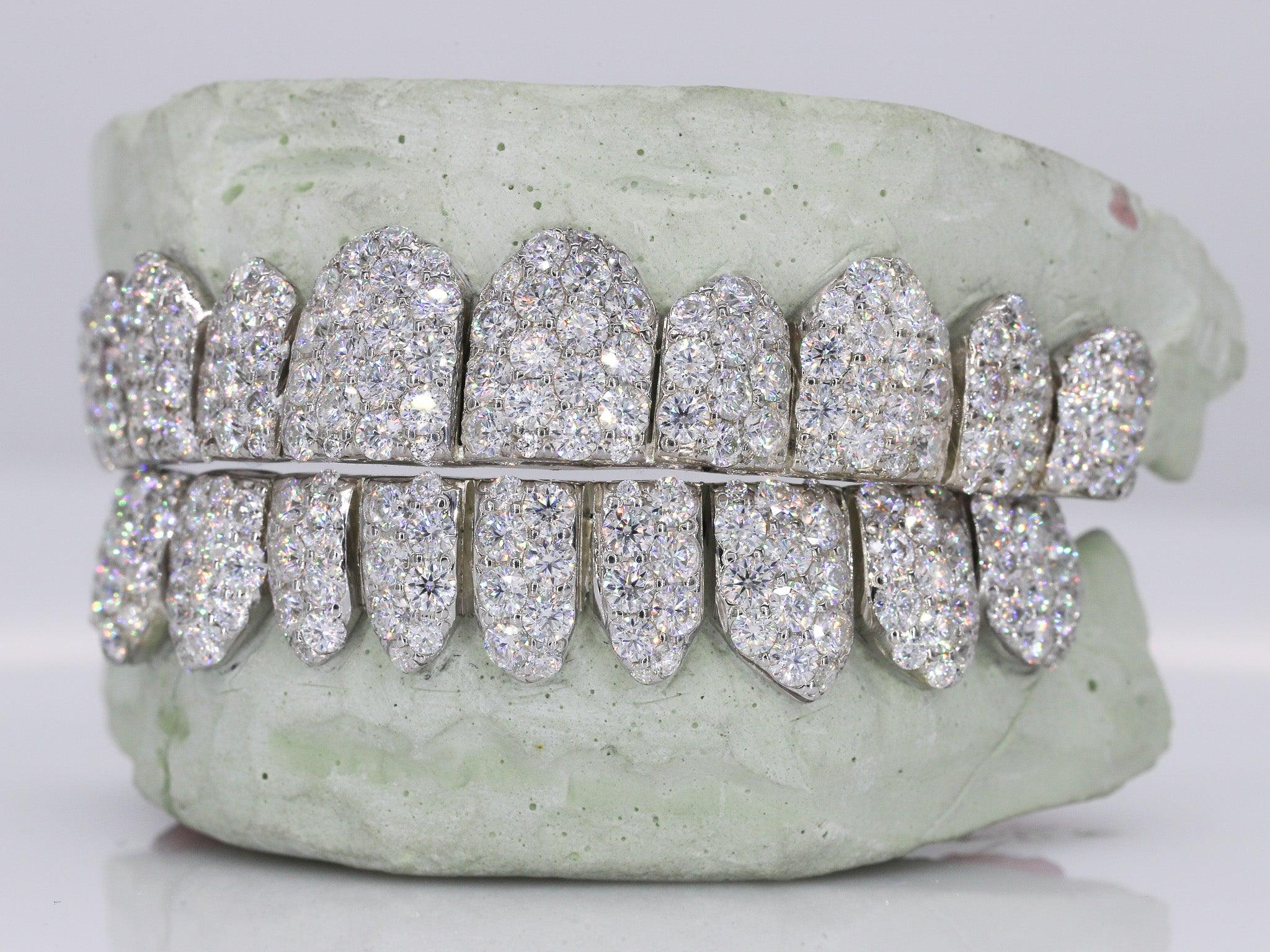 Jumbo VVS Moissanite Diamond Grillz - Moissanite Bazaar - moissanitebazaar.com