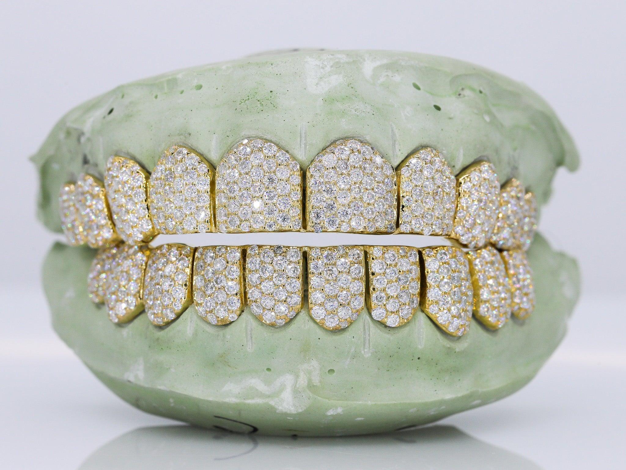 10 on 10 VVS Moisannite Diamond Grillz - Moissanite Bazaar - moissanitebazaar.com