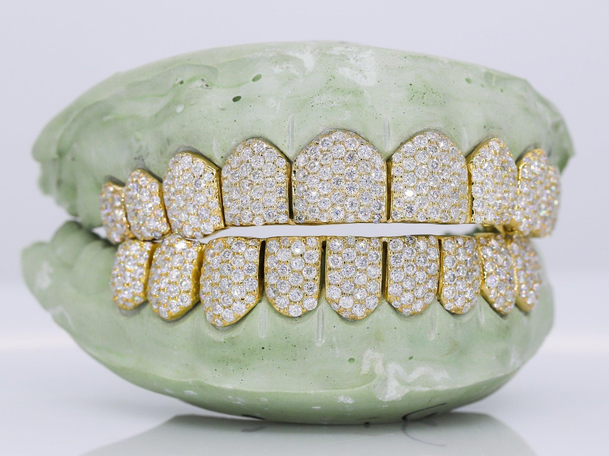 10 on 10 VVS Moisannite Diamond Grillz - Moissanite Bazaar - moissanitebazaar.com