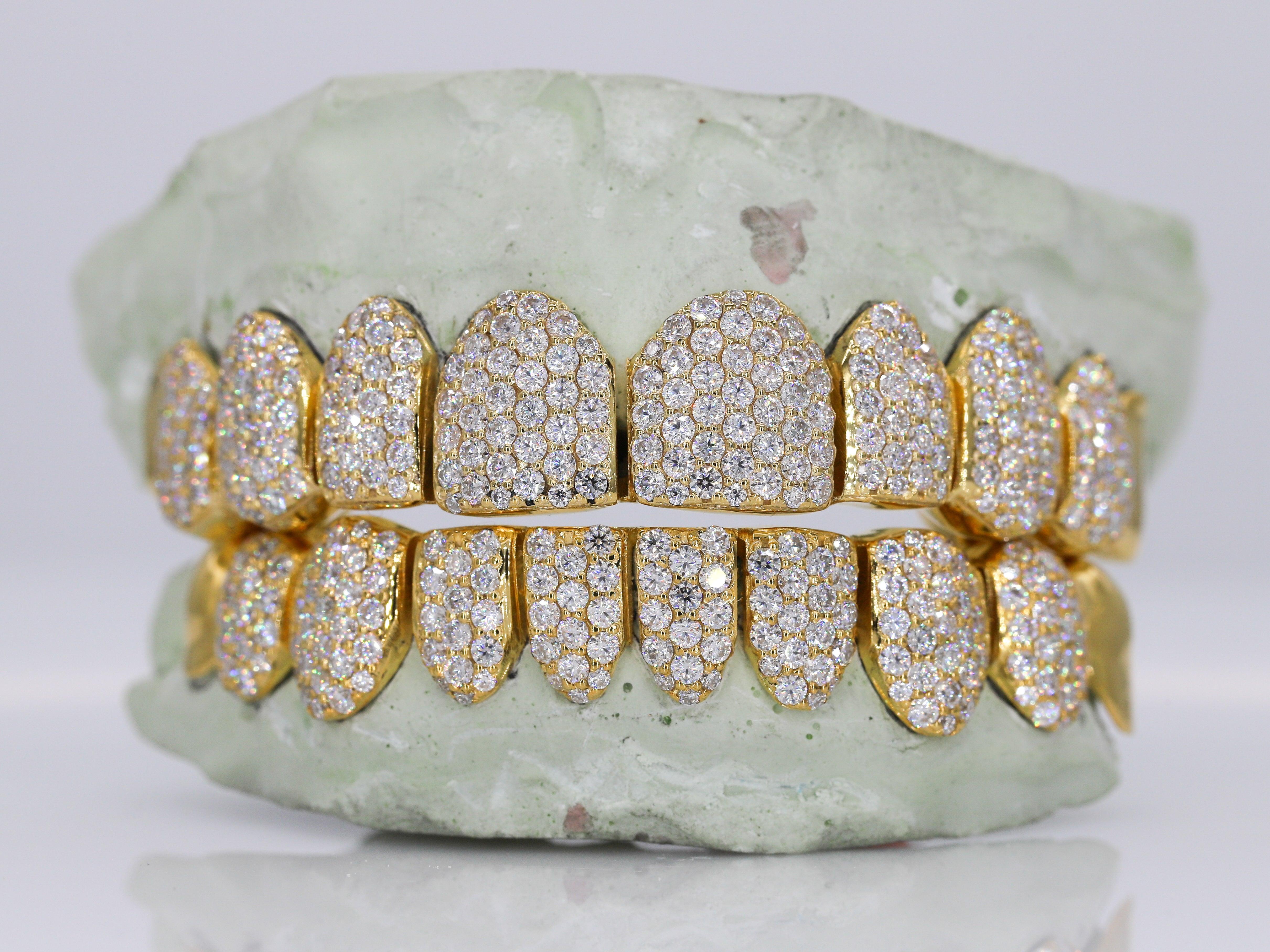 10 on 10 Capped VVS Moisannite Diamond Grillz - Moissanite Bazaar - moissanitebazaar.com