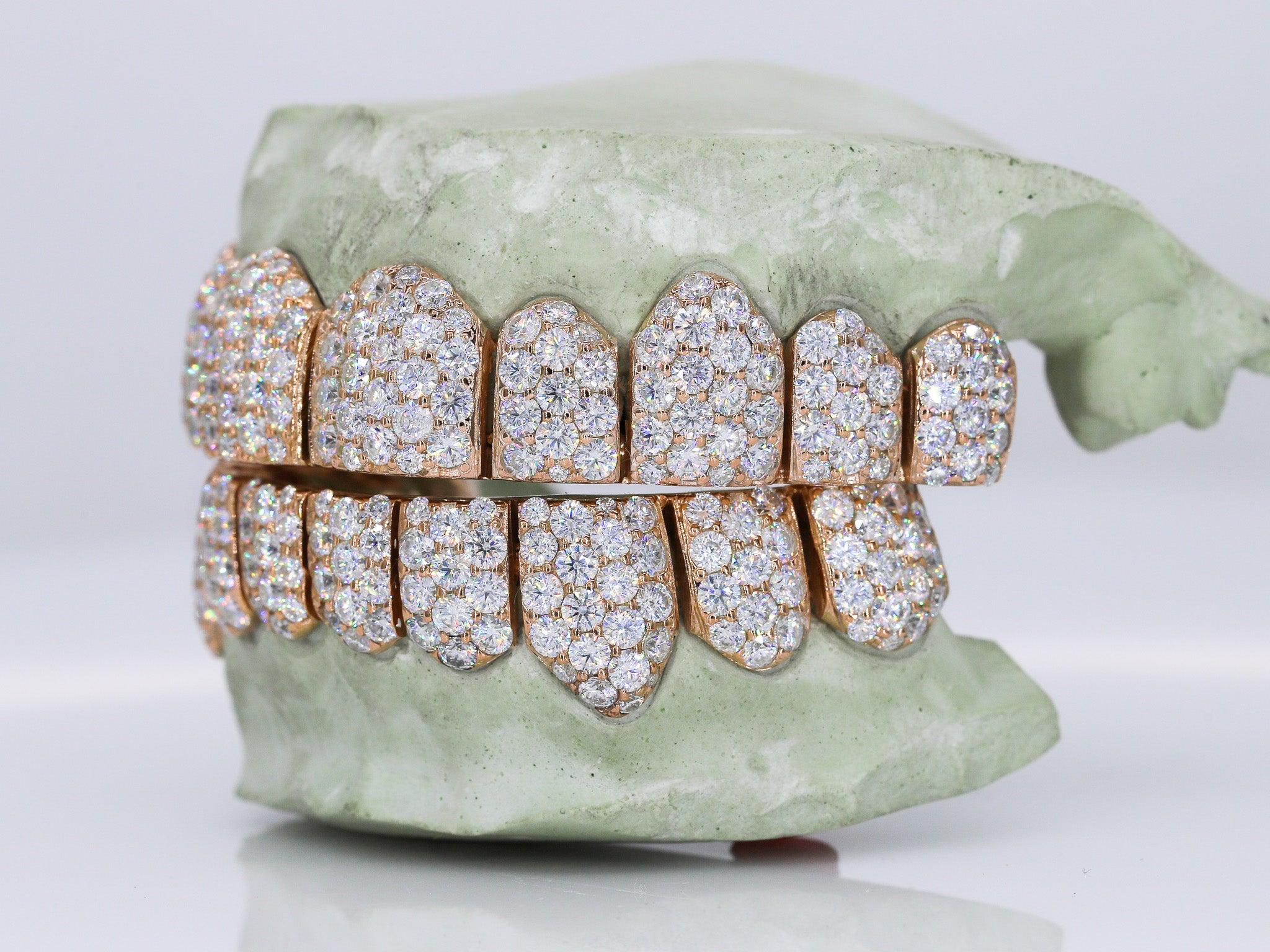 Jumbo VVS Moissanite Diamond Grillz - Moissanite Bazaar - moissanitebazaar.com