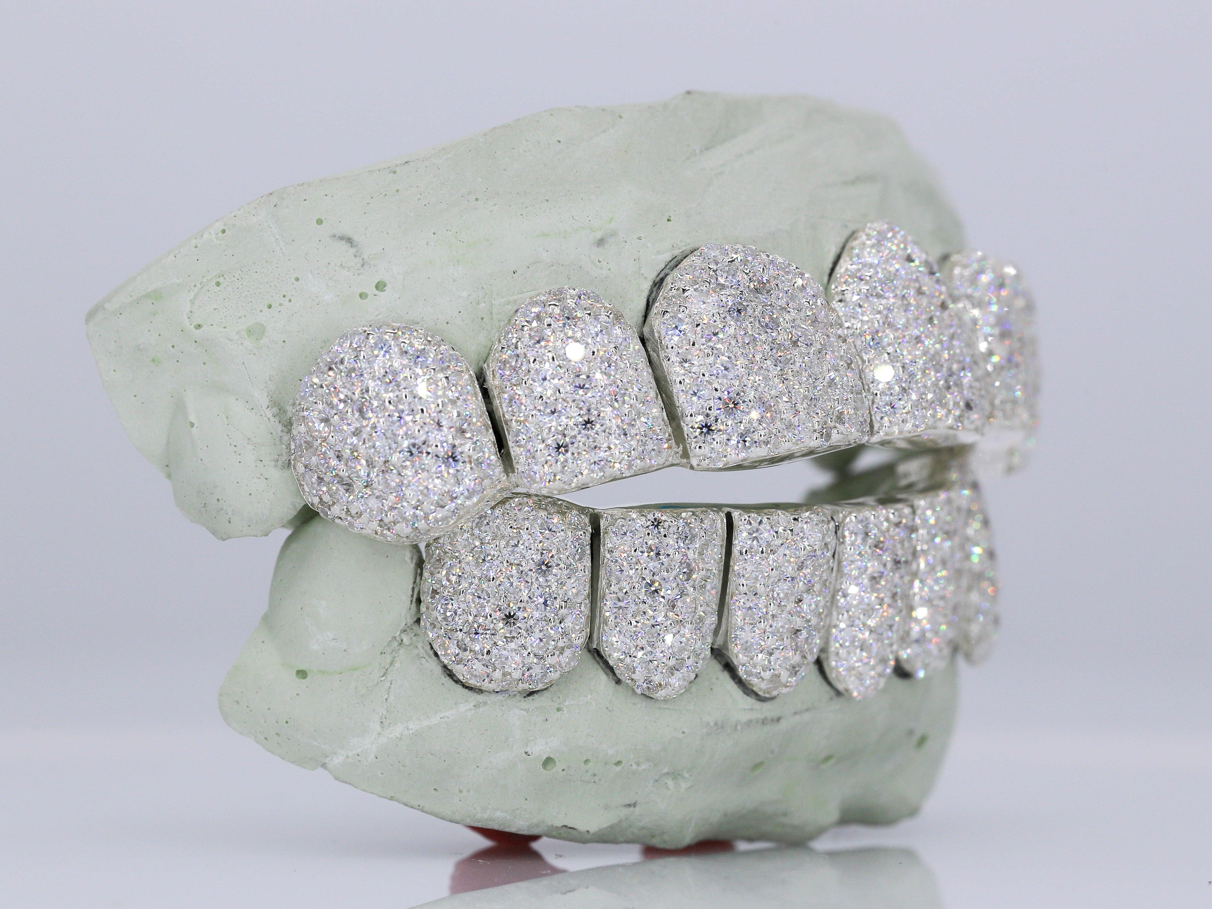 6 on 6 VVS Moissanite Diamond Grillz - Moissanite Bazaar - moissanitebazaar.com