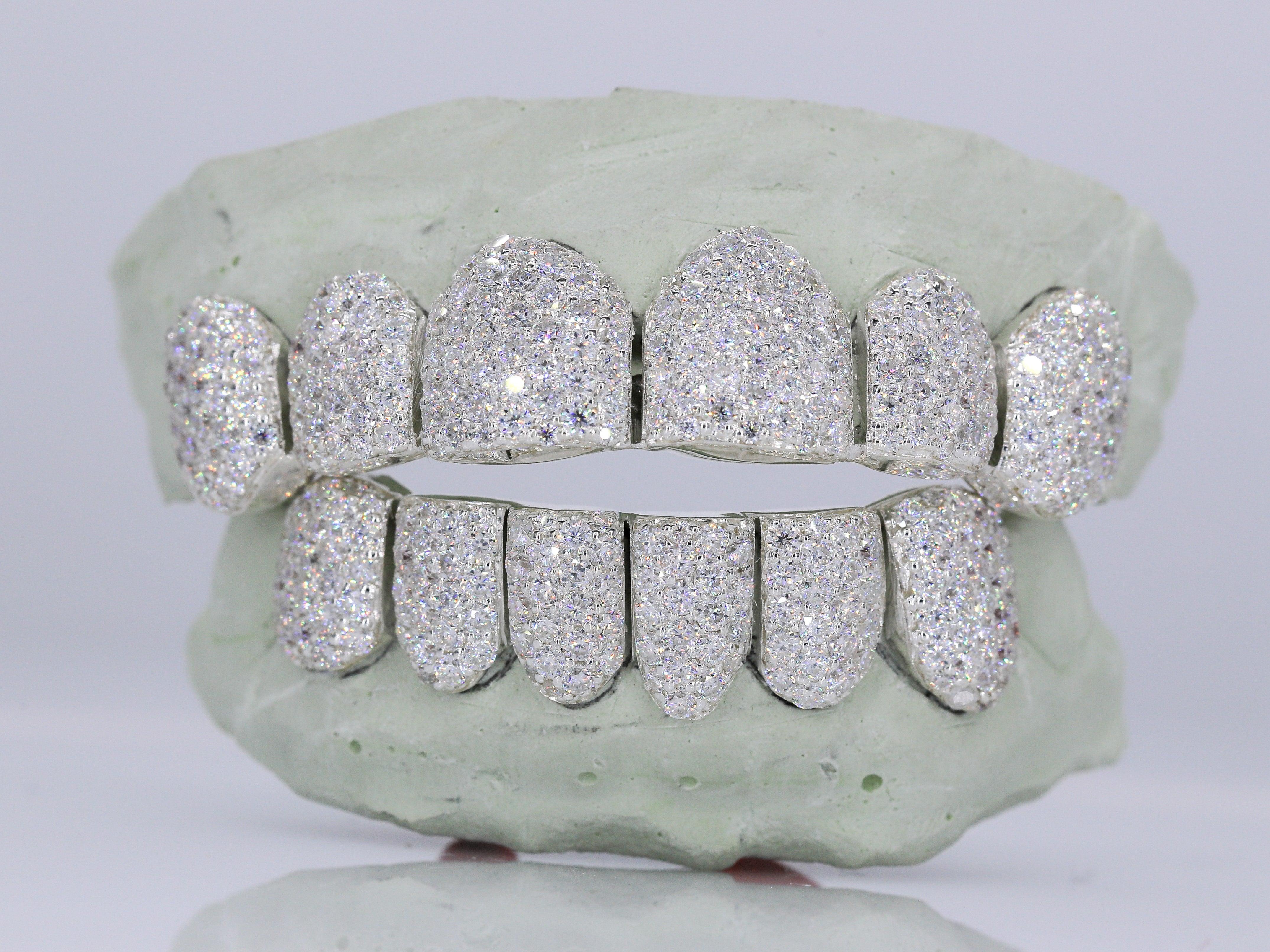 6 on 6 VVS Moissanite Diamond Grillz - Moissanite Bazaar - moissanitebazaar.com