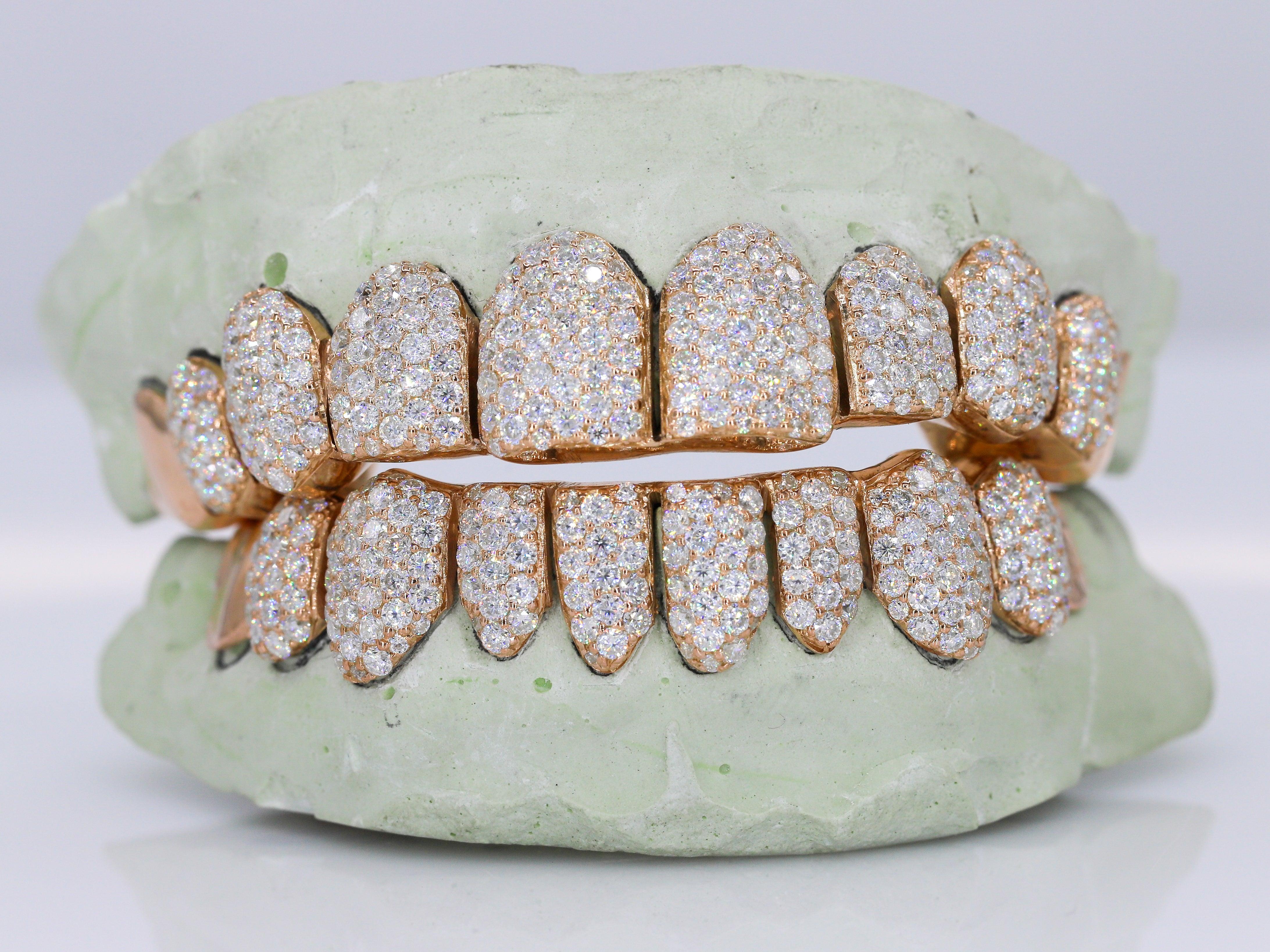 10 on 10 Capped VVS Moisannite Diamond Grillz - Moissanite Bazaar - moissanitebazaar.com