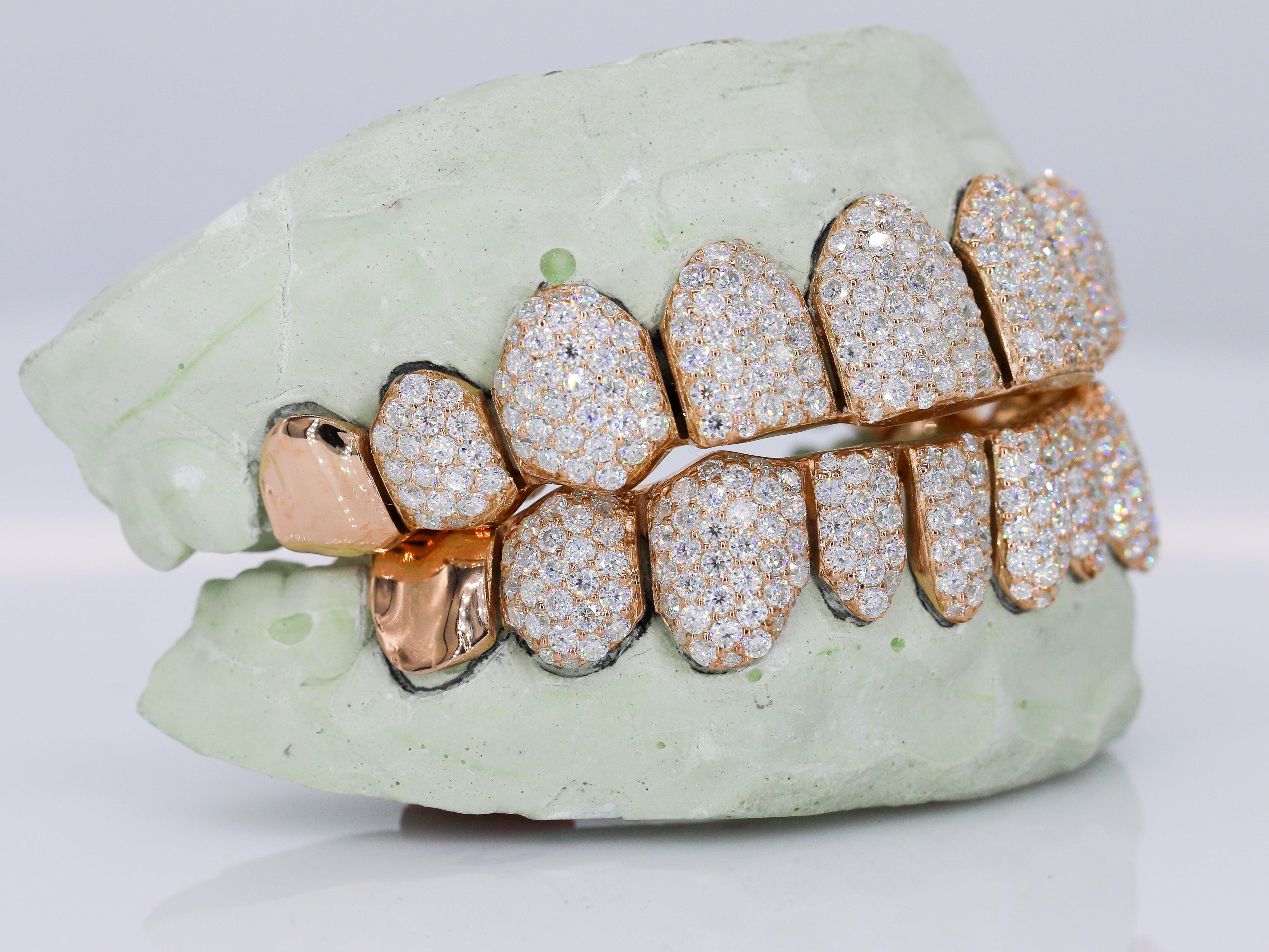 10 on 10 Capped VVS Moisannite Diamond Grillz - Moissanite Bazaar - moissanitebazaar.com