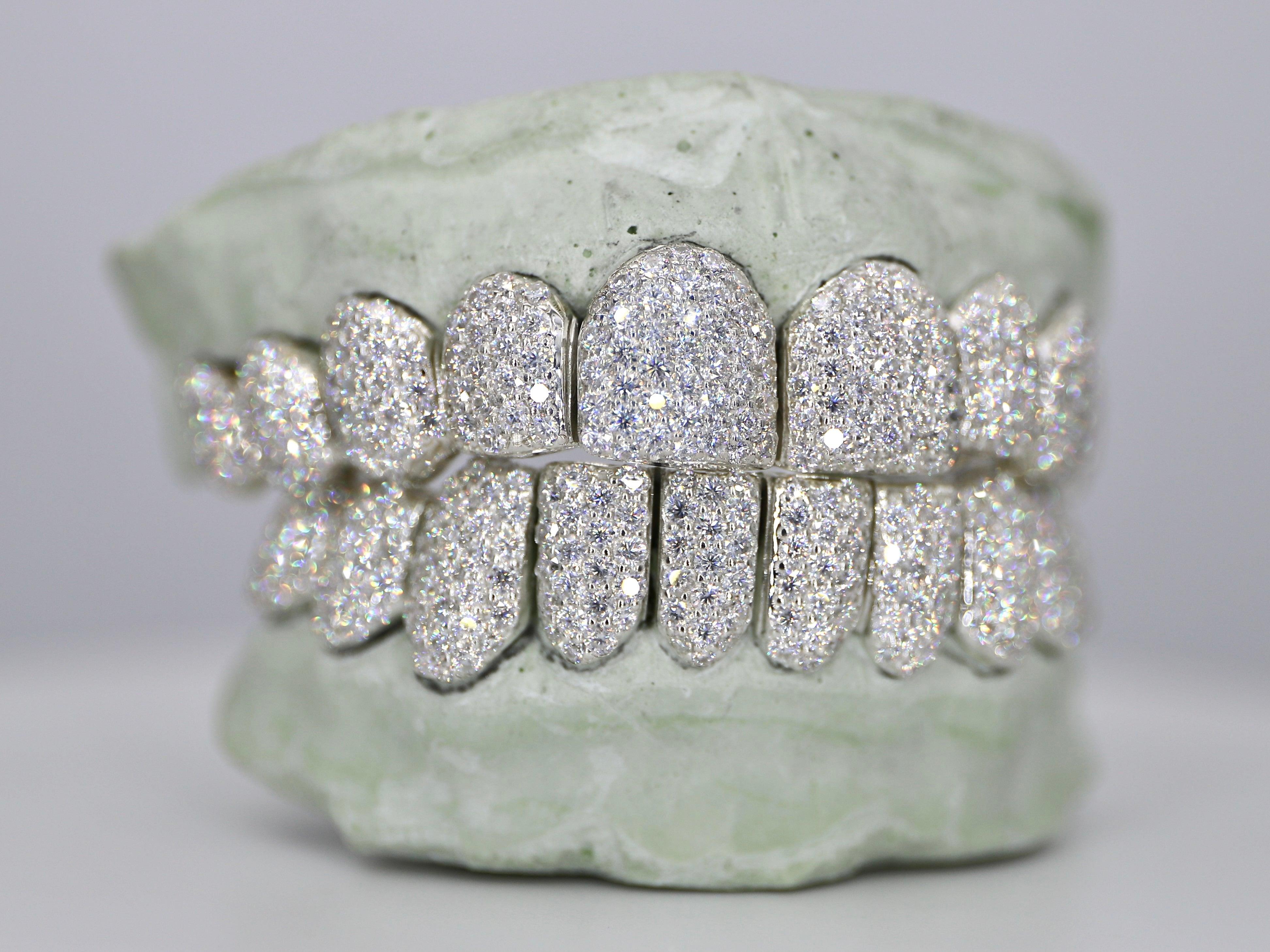 Custom Moissanite Diamond Grillz - Moissanite Bazaar - moissanitebazaar.com