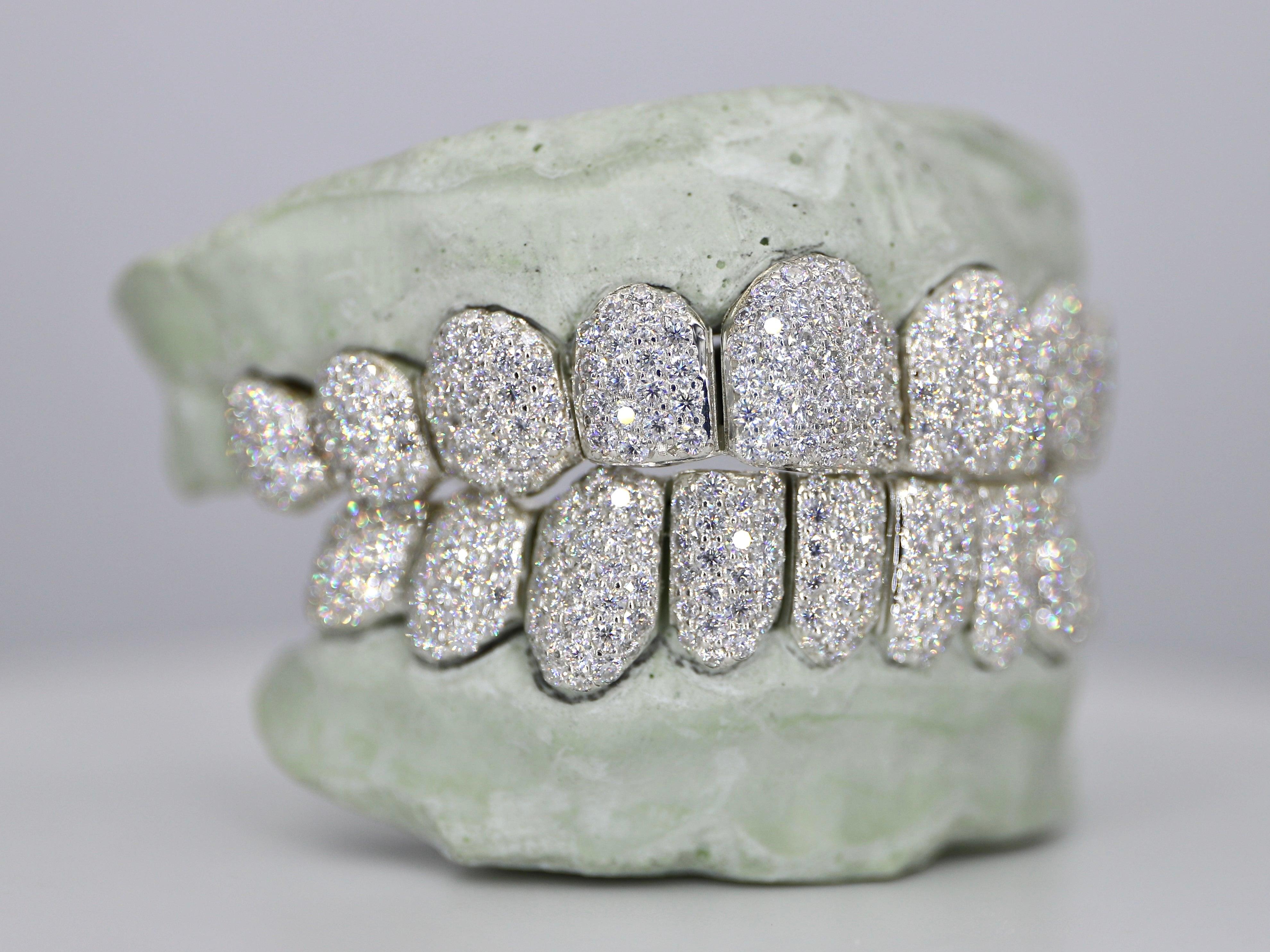 Custom Moissanite Diamond Grillz - Moissanite Bazaar - moissanitebazaar.com