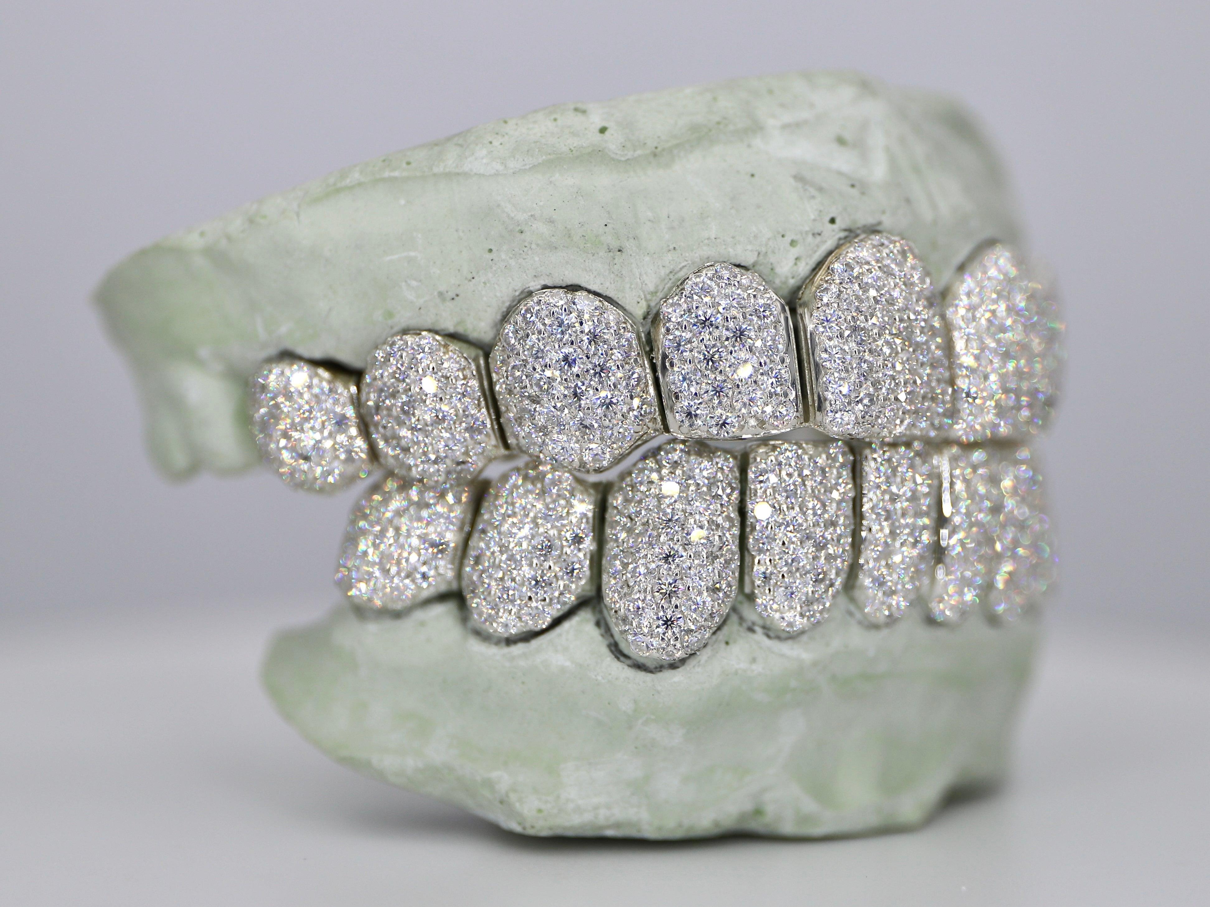 Custom Moissanite Diamond Grillz - Moissanite Bazaar - moissanitebazaar.com