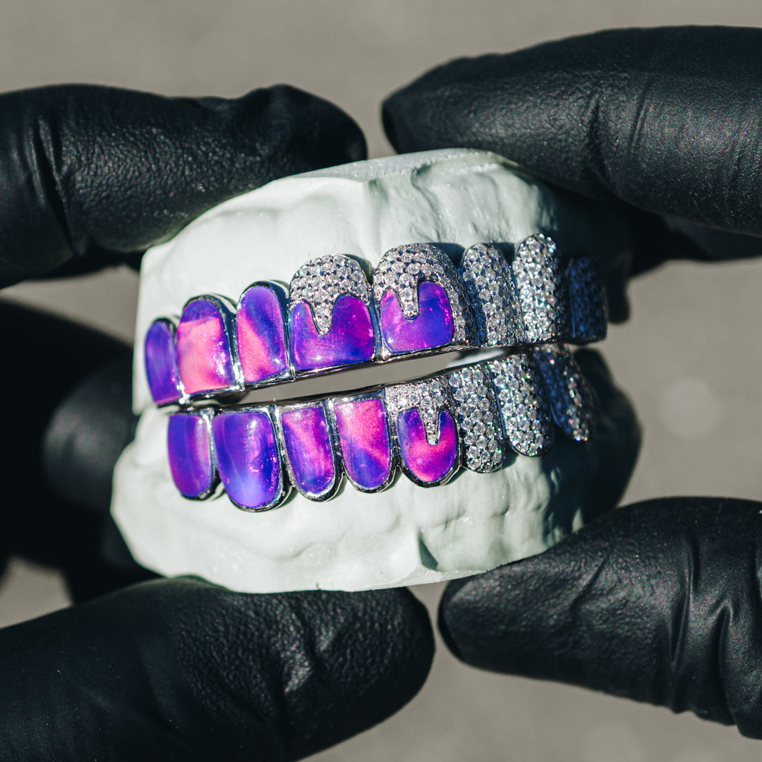 Iced Opals with VVS Moissanite Drips Grillz